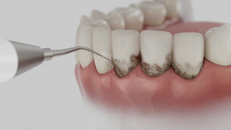 Trusted Tooth Extraction service in Andover, KS - Dentist Open Now